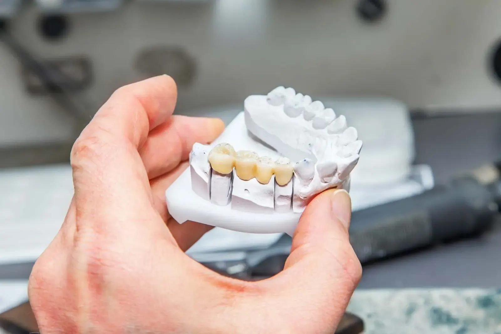 Restore Your Smile With Dental Bridges in Newkirk, OK